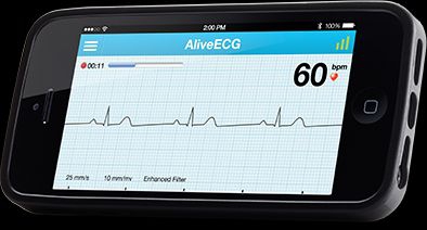 AliveCor