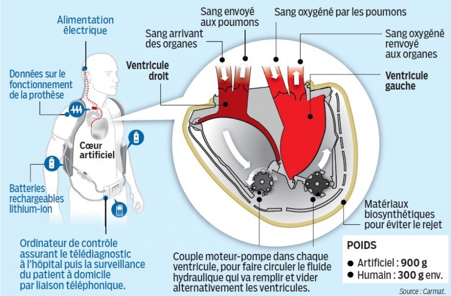 Carmat